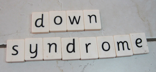 Down Syndrome Baby Dubai | https://www.pediatriciandubai.blog/development-of-children-dubai/down-syndrome-baby-dubai/ This Syndrome Affects Child's Mental & Physical Development