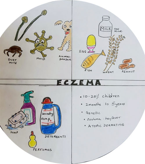 Eczema In Children Dubai | https://www.pediatriciandubai.blog/pediatrician-in-dubai/eczema-in-children-dubai/ Why Does My Child Have Skin Rash Despite Our Good Hygiene?