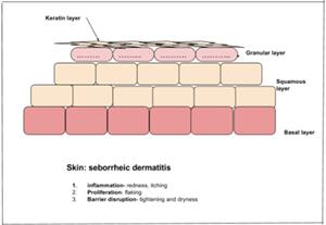 Seborrheic Dermatitis In Children Dubai | Does Your Child's Itchiness Require Professional Help?